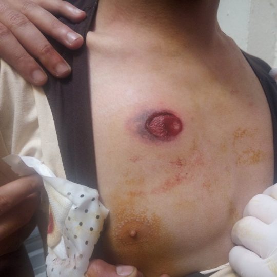 La police tire sur les manifestants avec des balles en caoutchouc, à Alger